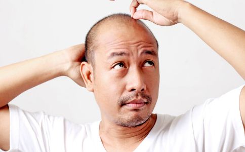 压力大脱发、男性中年秃头该怎么办