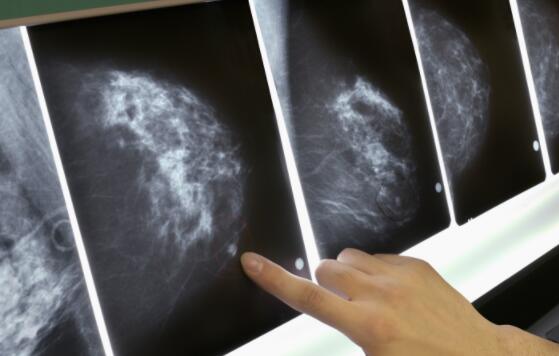 FDA:首个乳腺癌免疫疗法获FDA批准