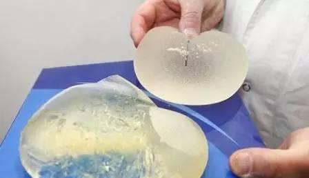 隆胸有风险！这款乳房植入物或致癌症，被全球召回