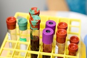 A型血人群更易感新冠病毒？专家：科学依据尚不充分