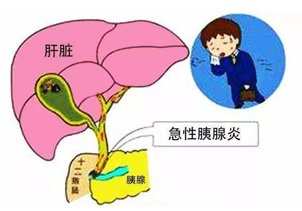 胰腺癌怎么预防，生活中饮食要注意什么？