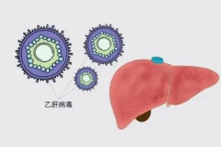 中西医结合治疗乙肝取得突破性成果