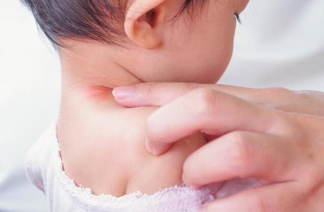 小孩出疹子可不能大意 很多东西是真不能吃的