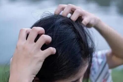 怎么防止脱发 脱发严重怎么办如何控制脱发